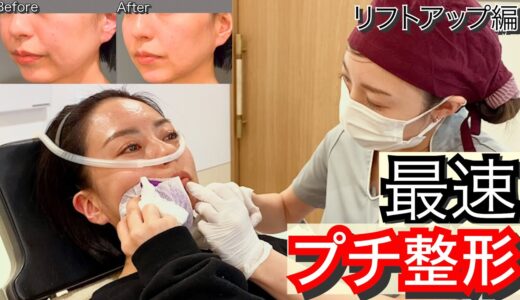 【美容クリニック】タルミが一瞬で消える！最短　効果バツグン　プチ整形