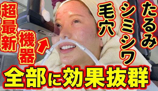 【肌質改善】毛穴、たるみ、シミやシワも改善できる最新美容機器を体験してきた！【美容整形・整形】