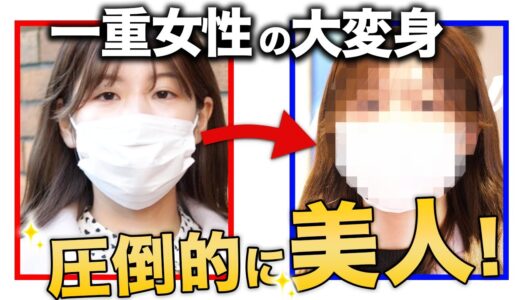 【人生逆転】人の目を見れない一重女性を二重美人にしてみた。