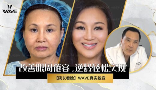 【真人案例】年过58？数次整形失败？但最后还是整成了温碧霞！