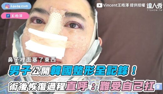 【男子公開韓國整形全記錄！ 術後恢復過程直呼：難受自己扛】 ｜Vincent王皓澤