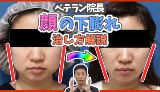 【小顔整形】下膨れ顔を整形やプチ整形で治す全ての方法を徹底解説