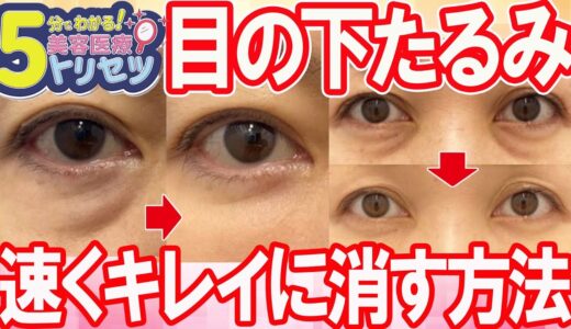 【美容医療（整形）のトリセツ】目の下のたるみをきれいに消す方法を5分で解説！【湘南美容クリニック】