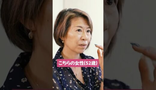 整形しないアンチエイジング美容医療「肌の再生医療」無料モニター症例 55歳女性 #Shorts