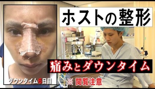 【ホストの美容整形完全密着】鼻の整形手術を乗り越えた先のダウンタイム。痛みやストレスと闘う。-File.06-