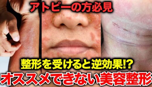 アトピーの人が受けない方がいい美容整形を医師が解説【アトピー性皮膚炎】