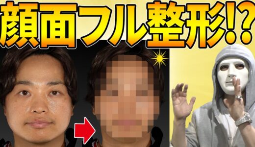 【男の美容整形】芸人さんが美容整形すると・・・【イケメンになる方法】