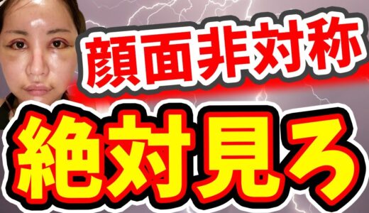 顔が左右非対称のアナタは見ないと損します。【美容整形・整形】