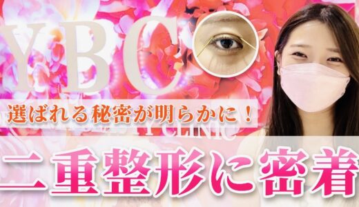 【美容整形】二重埋没法密着動画！YBCが選ばれる理由が明らかに！シミュレーション、ダウンタイム、ビフォーアフター、感想付き