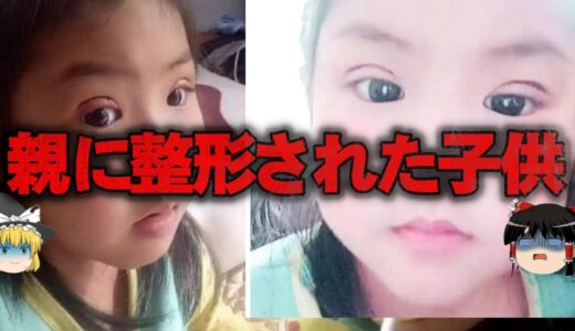 【ゆっくり解説】残酷すぎる…親に整形手術させられた子供たちをゆっくり解説