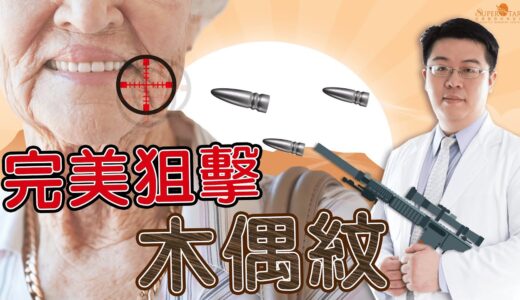 完美狙擊木偶紋!!｜巨星整形外科｜林敬鈞｜木偶紋｜全層次結構式拉皮｜拉皮｜下垂