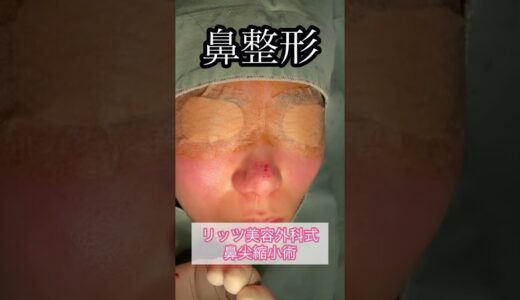 鼻先を細くする美容整形です！！