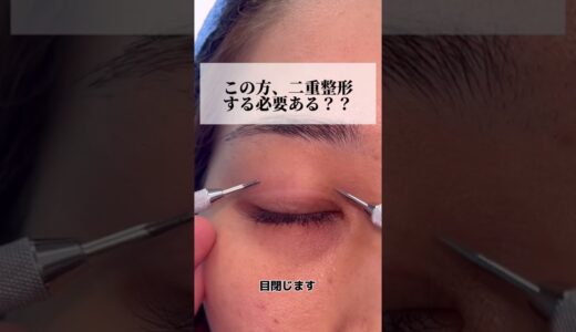 【二重整形】この方、二重整形する必要ある？？　#shorts