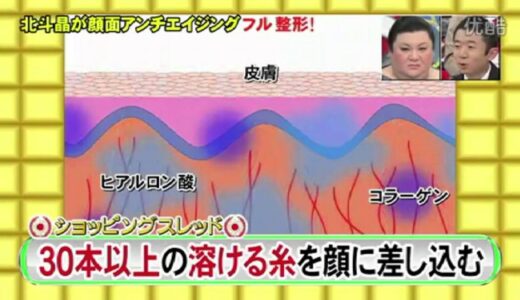 アンチエイジング　美容整形