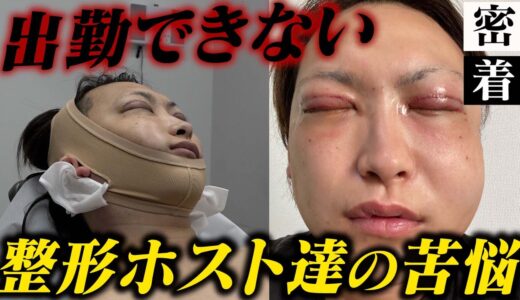 【整形後の苦悩】32歳のホスト達の整形を終えた後の生活に密着【TOPDANDY V】