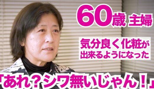 整形しないアンチエイジング美容医療「肌の再生医療」ビフォーアフター｜60歳 女性｜3ヶ月検診