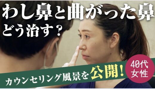 曲がった鼻と鷲鼻を美容整形でどう治す？鼻の形に悩む40代女性のカウンセリングをお見せします【リッツ美容外科】#鼻整形