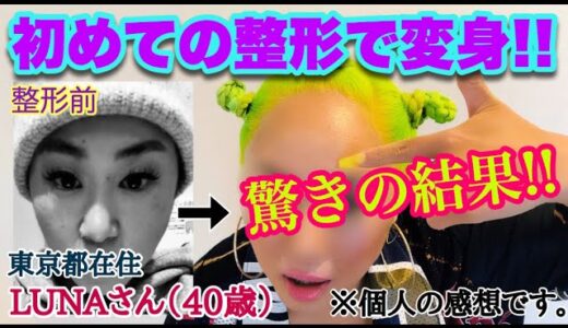 【検証】人生初の「美容整形」したら、驚きの結果が出た！！