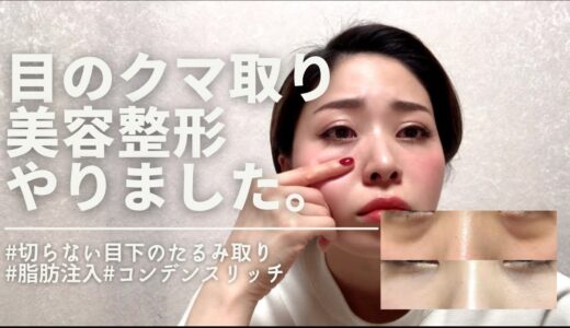 【クマ取りの美容整形】切らない目の下のたるみ取り+脂肪注入法レポ