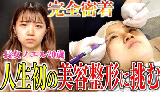 【密着ドキュメント】長女ノエル20歳が人生初の美容整形に挑戦！二重プチ整形・埋没法とは？