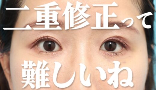 【二重整形】修正した経過について。状況をお話します。