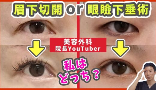 【目の開き】眉下切開と眼瞼下垂術のどちらを選ぶべき？症例写真を付きで比較解説【まぶた（瞼）の整形】