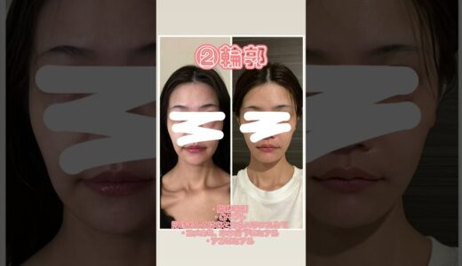 美容整形の順番は？🤔💭