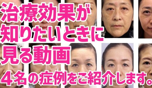 整形しないアンチエイジング美容医療「肌の再生医療」ビフォーアフター４選｜とにかく治療効果を知りたい方が見る動画