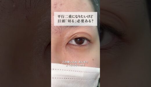 【二重整形】平行二重になるには目頭を「切る」必要ある？