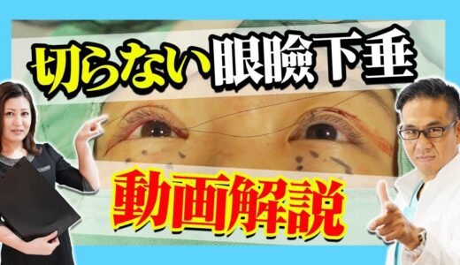 【美容整形】ぱっちりした目を手に入れよう！ 切らない 眼瞼下垂治療！