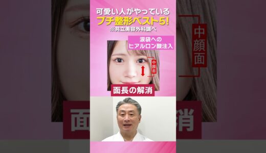 【美容整形】可愛い子はやっている？！プチ整形５選 #shorts