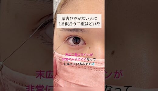 【二重整形】蒙古襞がない人の二重整形　#shorts