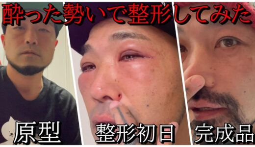 【美容整形】酔った勢いで整形しちゃいました【整形費用公開】