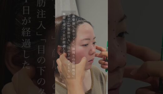 【フル美容整形】総額390万超えのフルカスタム整形【鼻整形/若返り整形】#shorts