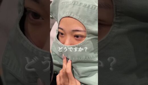 【二重整形】YoutuberPKAあっぷるさん二重整形直後まで密着物語！　#shorts