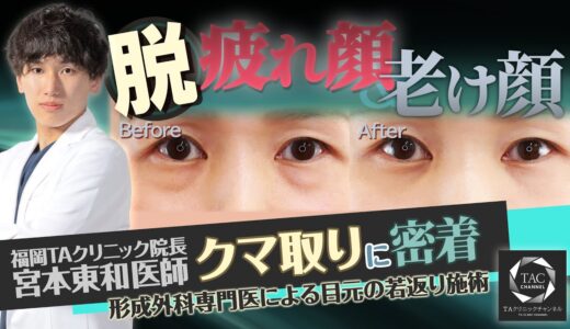 【美容整形】目の下のクマ取り施術で－〇歳？！施術から症例まで解説！【TAクリニック】