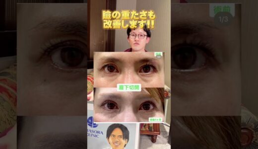 【エイジングケア】やると一気に若返る美容整形３選