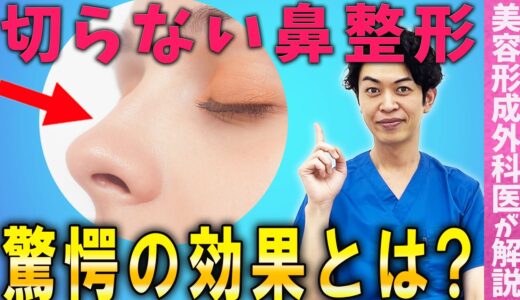 【鼻整形】糸による鼻の美容整形の効果とは？【クレオパトラノーズ】