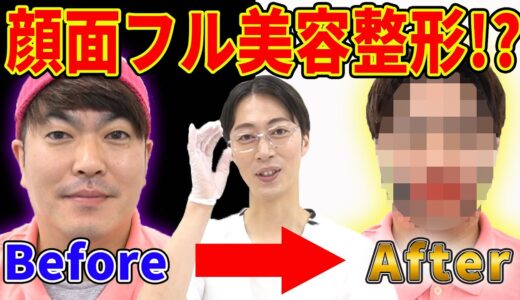 【衝撃のAfter】金田医院長の整形技術がスゴすぎた…!!【はんにゃ金田】