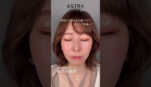 太さのある鼻を細くシャープに😊#美容整形 #鼻整形 #astrabeautyclinic