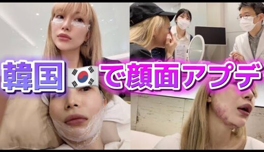 二重顎と目の下のシワ消えた！？韓国美容整形おすすめアンチエイジング！美容クリニックはしご経過レポ