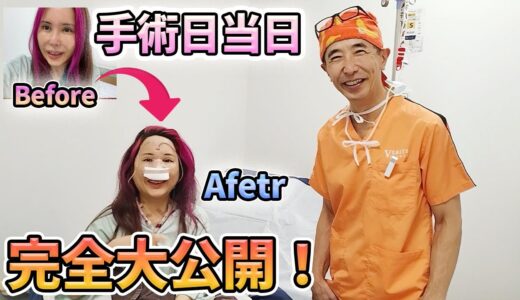 【密着】鼻中隔延長/貴族整形 手術日当日！【鼻整形】【美容整形】　(手術シーンなし）