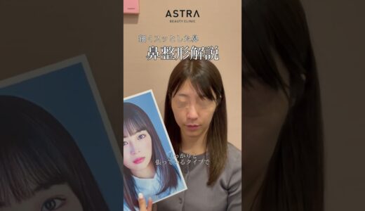 【鼻整形解説】細くスッとした鼻👃#美容整形 #鼻整形 #astrabeautyclinic