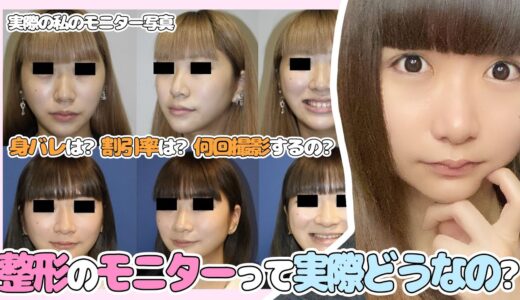 【美容整形】モニターって実際どうなの！身バレは？割引率は？