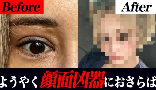 【悲願】整形の後遺症。先生、ボロボロの顔を助けて。