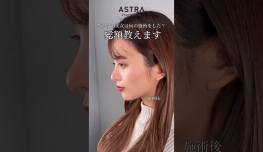 美女から爆美女へ🤳✨#美容整形 #鼻整形 #astrabeautyclinic