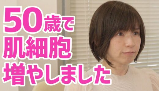 50歳女性｜整形しないアンチエイジング美容医療「肌の再生医療」ビフォーアフター｜6ヶ月検診