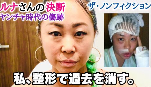 【美容整形】メスを使わず、傷跡・毛穴・ニキビ跡を消す施術を色々初体験！！【最新・最先端・肌再生治療】