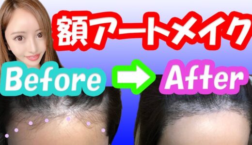 【美容整形】額アートメイク・ヘアラインアートメイク