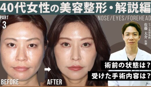 40代女性の鼻と目元の美容整形、佐藤大介医師が手術内容を解説！③ リッツ美容外科